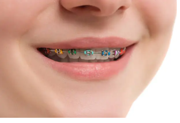 Unveiling Your Best Smile: Practical Tips for Enhancing Your Grin Unveiling Your Best Smile: Practical Tips for Enhancing Your Grin